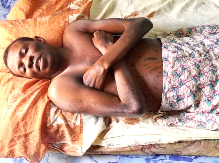 Abi-born Daniel Imo, Paralysed for 23 Years, Cries out for Help